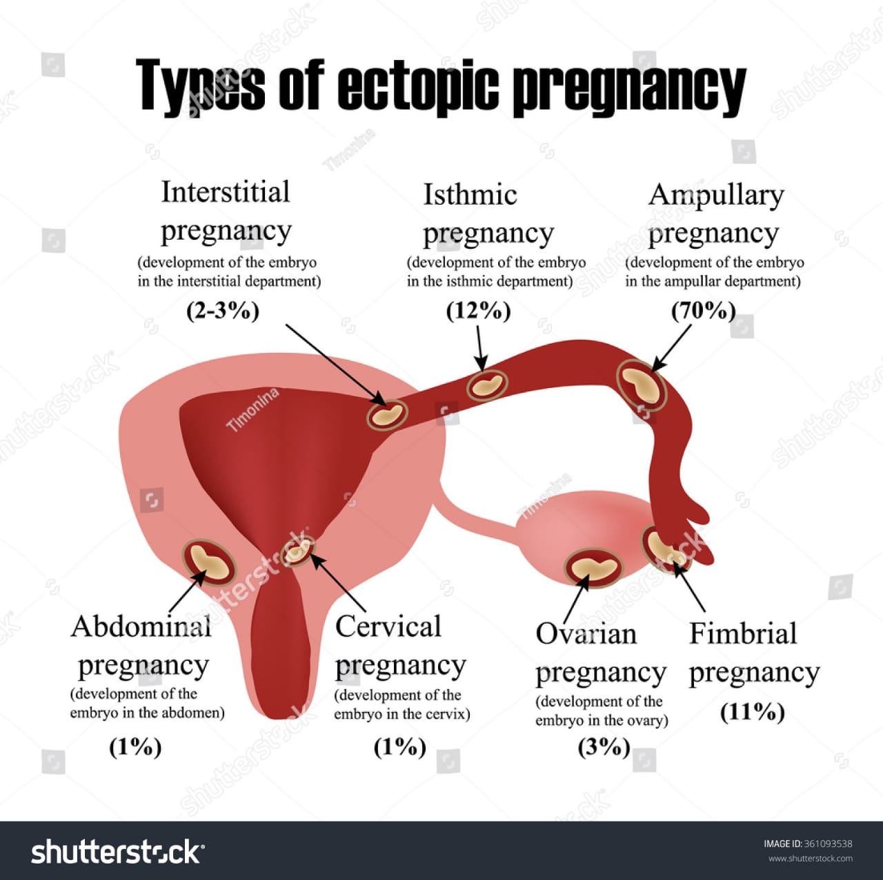 Pregnancy Pregnancy